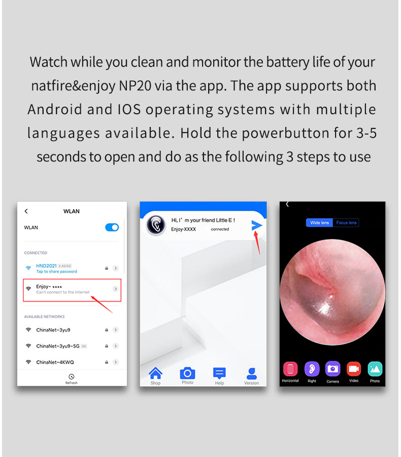 Wireless Smart Ear Cleaner with Camera - Clear Your Ears with Ease