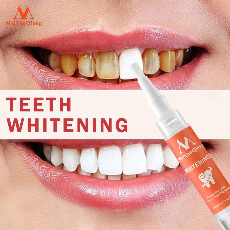 Instant Teeth Whitening Pen for a Brighter Smile - Easy and Effective!