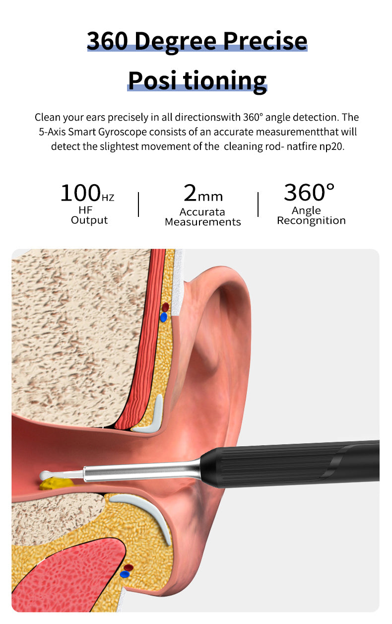 Wireless Smart Ear Cleaner with Camera - Clear Your Ears with Ease
