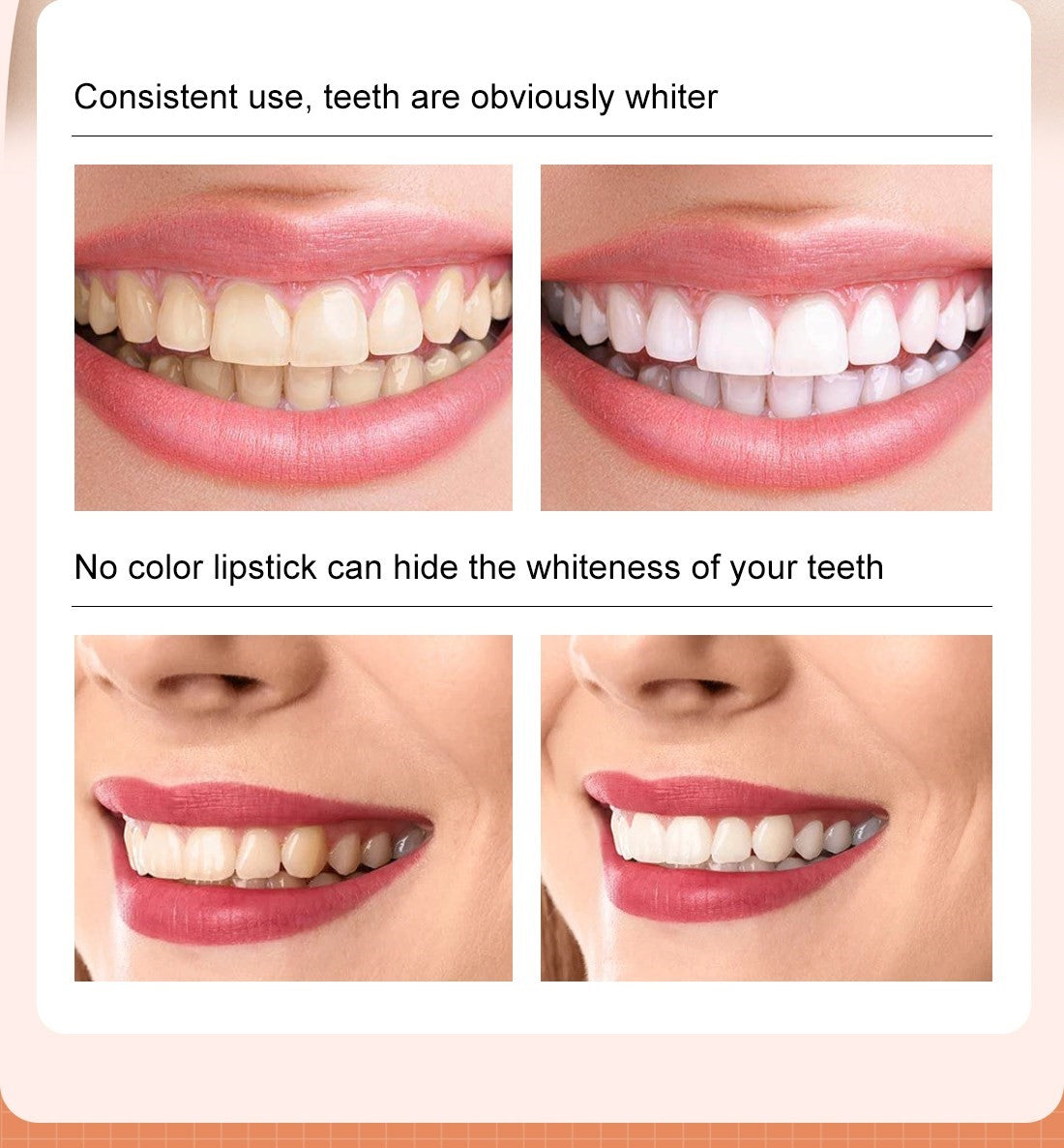 Instant Teeth Whitening Pen for a Brighter Smile - Easy and Effective!